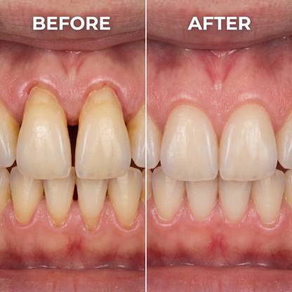 Thrivia Teeth Repair Gel